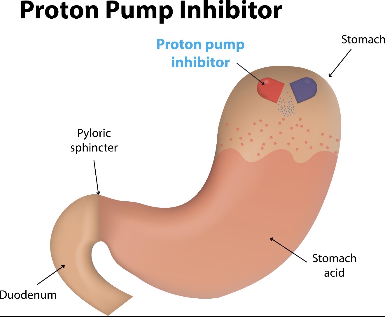 Mide Yanması ve Reflü ile Başa Çıkma Rehberi: OMHEAL Nedir, Nasıl Kullanılır?